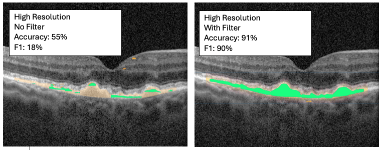 Enhancing Deep Neural Networks with Human Computation Games for Accurate Retinal Layer Segmentation