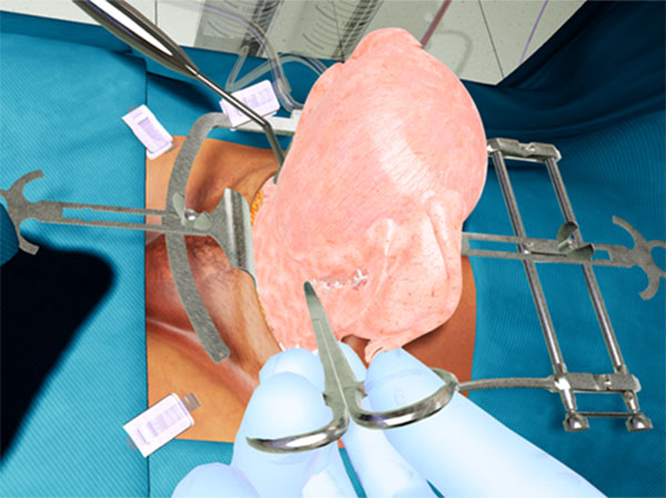 Screenshot of Virtual Reality Surgery, as it appears thru VR headset, for a cesarean delivery